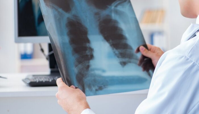 Taakherschikking onder de loep: afstemming tussen PA en radioloog niet voldoende